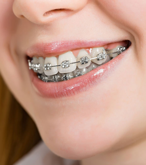 Bayat - Orthodontics