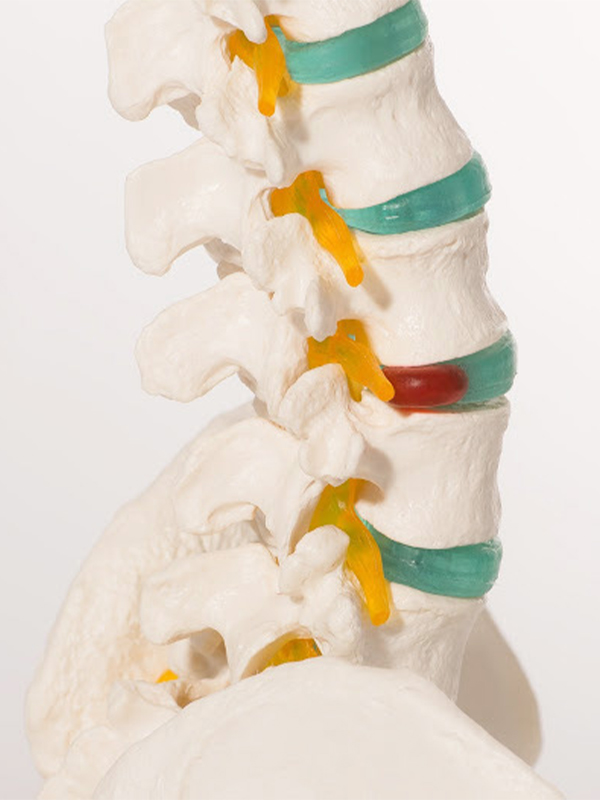 Clinique Spinecor - Colonne vertébrale